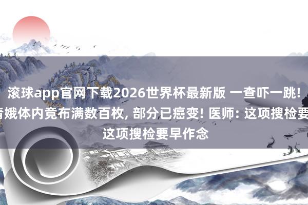 滚球app官网下载2026世界杯最新版 一查吓一跳! 16岁青娥体内竟布满数百枚, 部分已癌变! 医师: 这项搜检要早作念