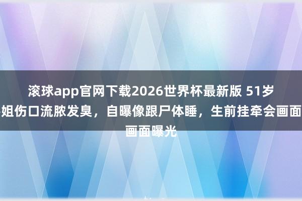 滚球app官网下载2026世界杯最新版 51岁前港姐伤口流脓发臭，自曝像跟尸体睡，生前挂牵会画面曝光